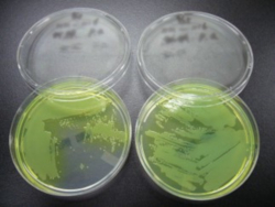 緑膿菌