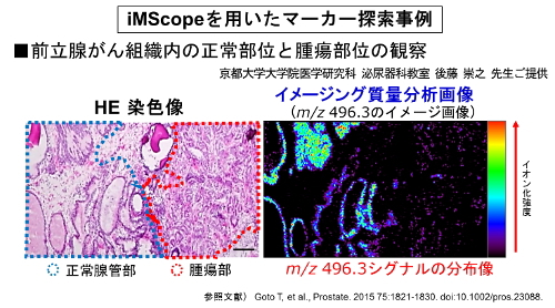 iMScopeを用いたマーカー探索事例