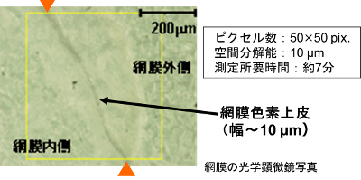 網膜の光学顕微鏡写真