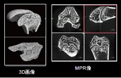 マウス大腿骨のCT画像